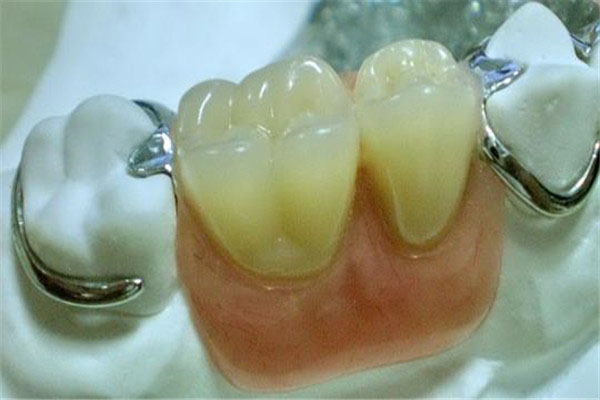 上海义齿加工厂有哪些地方好一点(上海义齿加工厂有哪几家)