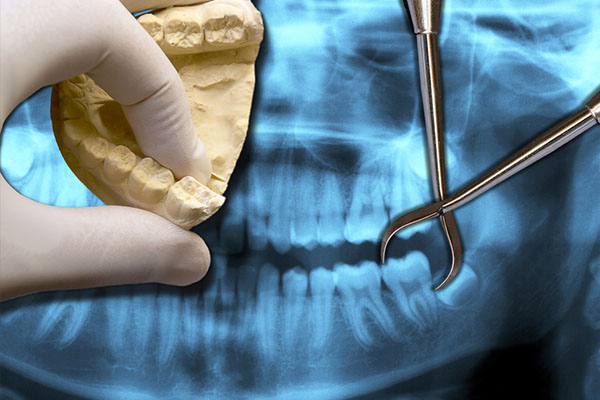 儿童树脂填充牙大概需要多少钱呢(儿童树脂填充牙大概需要多少钱呢)