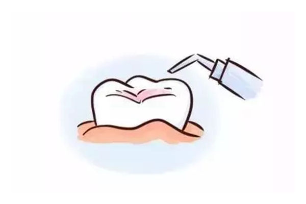 一岁半宝宝牙齿脱矿涂氟能恢复吗