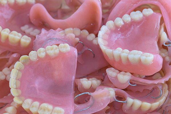 bps义齿的利和弊(bps义齿牙有什么优势)