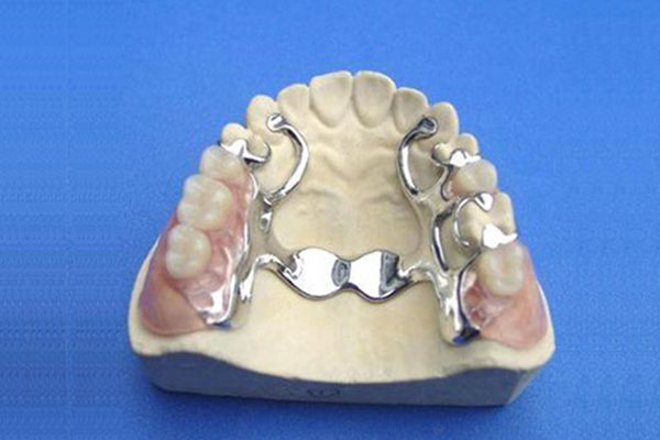 树脂做的工艺品(树脂做的工艺品容易碎吗)