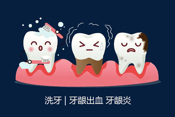 一般医院洗牙价格多少一次啊怎么收