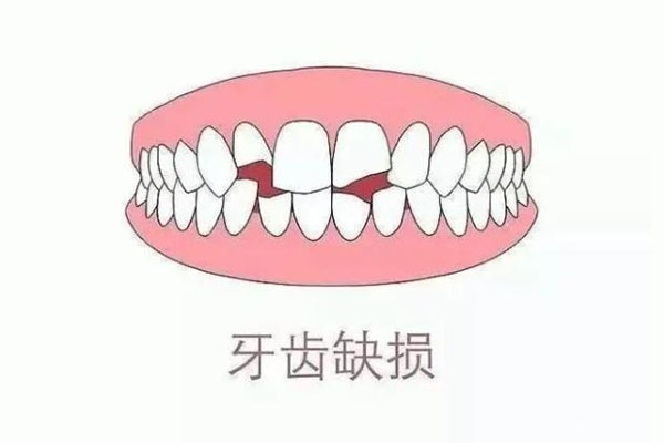 牙体缺损严重可以戴冠吗(牙体缺损严重可以戴冠吗)