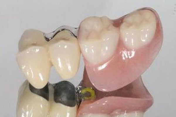 上海义齿公司有几家上市公司(上海义齿公司有几家上市公司股票)