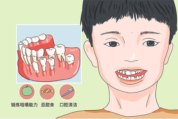 20岁乳牙滞留要拔吗(20岁乳牙滞留要拔