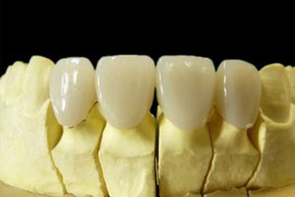 一个牙冠大概多少费用北京医保报销(一个牙冠要多少钱)