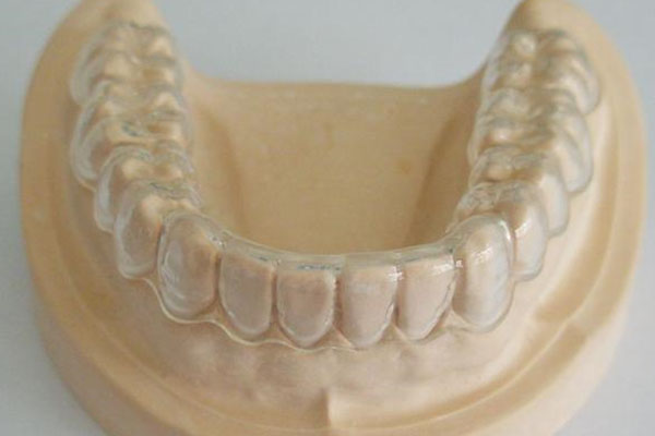 上海速城义齿(上海速城义齿有限公司)