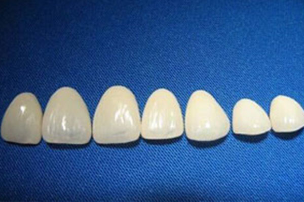 义获嘉全瓷贴面是哪国的产品(义获嘉全瓷贴面是哪国的产品品牌)