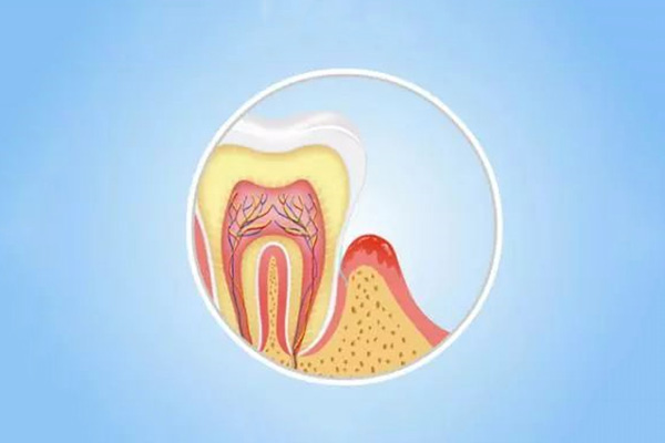 70多岁还能种植牙吗为什么呢(70多岁还能种植牙吗为什么呢图片)