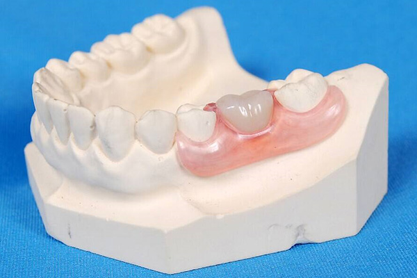 树脂地沟盖板能过车吗(树脂地沟盖板价格)