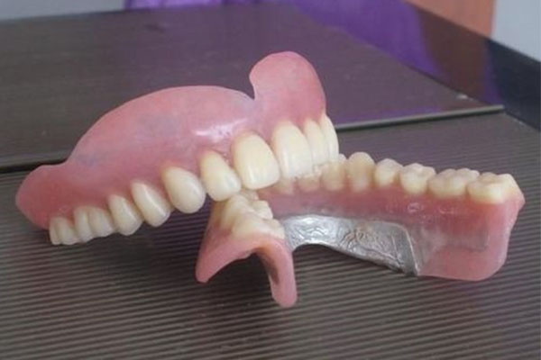 上海义齿加工厂有哪几家厂(上海义齿加工厂有哪几家厂子)