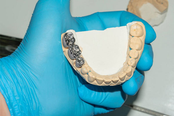 一副义齿多少钱一颗(一副义齿多少钱一颗图片)