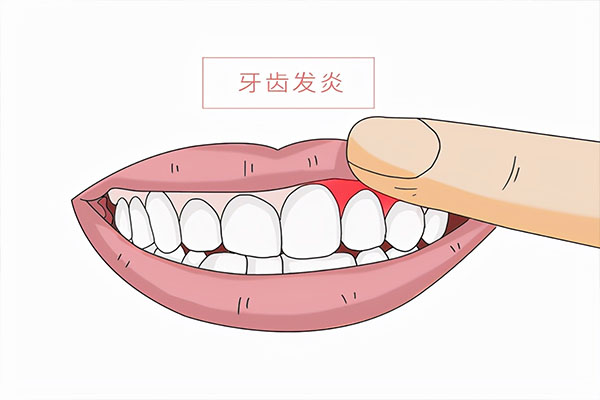 严重的牙周病能治好吗(严重的牙周病