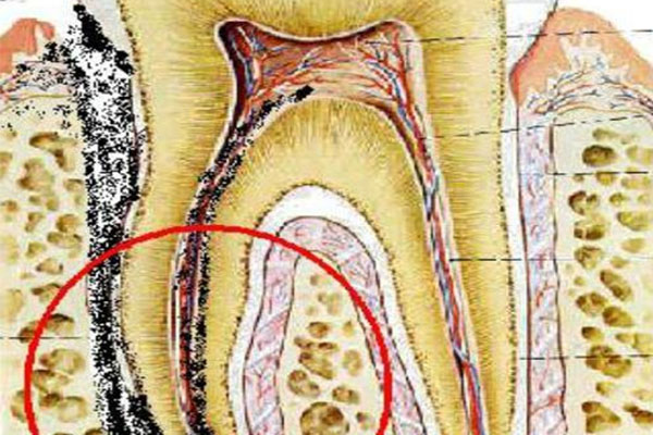 牙体缺损修复术可以用医保吗(牙体缺