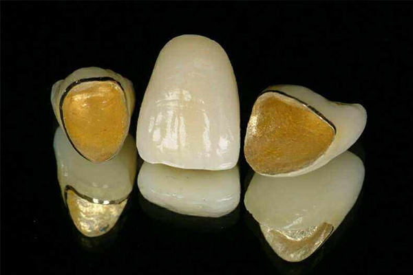 一个全瓷的牙套多少钱一副(一个全瓷