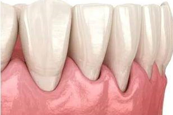 30岁牙龈萎缩牙齿掉光了怎么办(30岁牙龈萎缩牙齿掉光了怎么办呀)