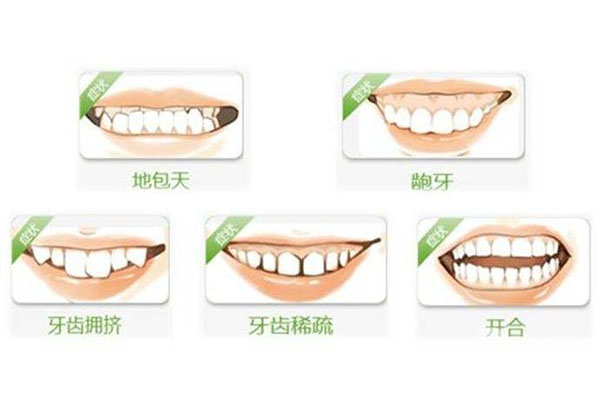只有一颗牙齿不齐怎么矫正呢一文通晓清晰