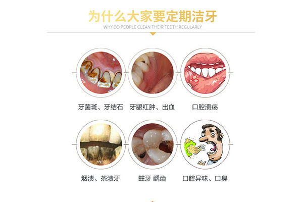 一般洗牙和超声波洗牙区别是什么(一