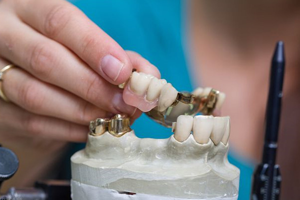 一个义齿怎么放进去的(一个义齿怎么放进去的视频)