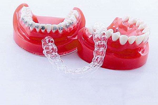 树脂冠和全瓷冠哪个好(树脂冠和全瓷冠哪个好些)