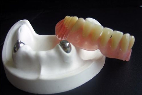 上海义齿加工厂排名前十的有哪些厂家(上海义齿加工厂排名前十的有哪些厂家