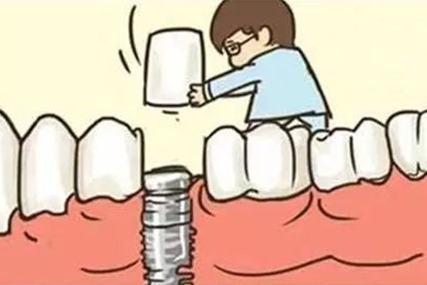 70多岁能种牙吗(70多岁能种牙吗?)