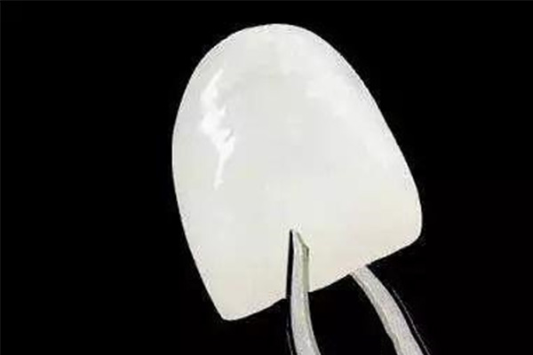 做了牙齿贴面怎么去掉(做了牙齿贴面怎么去掉牙结石)