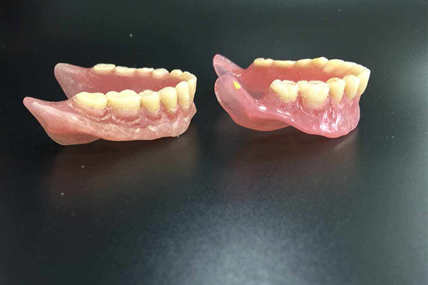 上海义齿加工厂有哪些厂家招聘(上海义齿加工厂有哪些厂家招聘的)