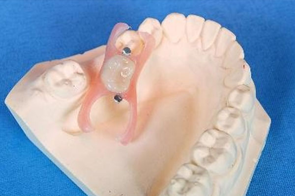 3mz350树脂好还是250好(3m树脂350和250的区别)