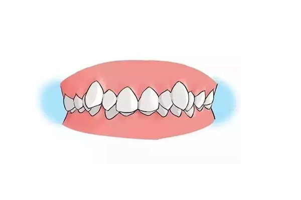 2岁小孩地包天如何矫正(两岁小孩地包天怎么办)