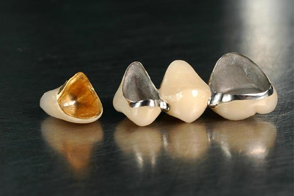 10岁牙齿地包天矫正费用(10岁地包天牙齿矫正需要多久)