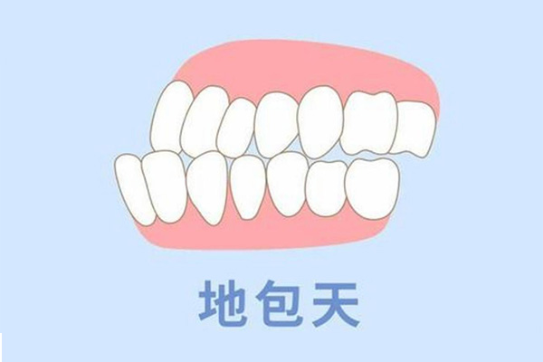18岁地包天牙齿矫正的过来吗(十八岁地包天还能整吗)