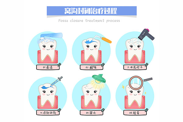 小孩牙涂氟到多大不用涂了(小孩牙涂氟到多大不用涂了呀)