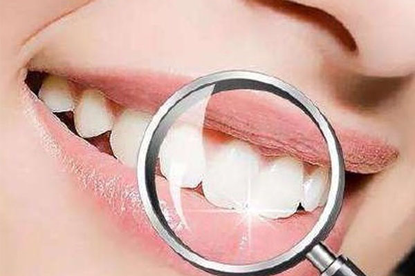 严重的氟斑牙怎么治疗好(严重的氟斑