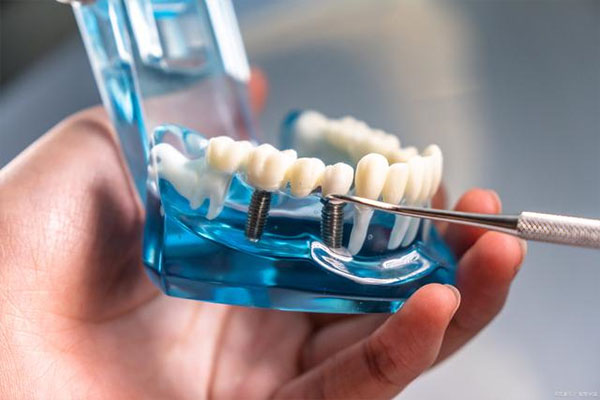 树脂牙的优点有哪些(树脂牙的优点有哪些方面)