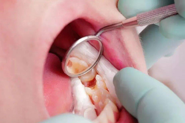 9岁地包天矫正(9岁地包天矫正需要多长时间)