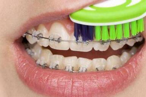 牙列拥挤的矫治方法不包括什么(牙列拥挤的矫治方法不包括什么操作)