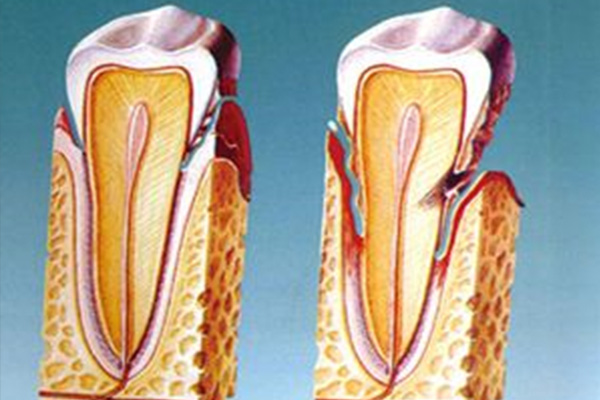 50多岁牙龈萎缩正常吗为什么(50多岁牙龈萎缩正常吗为什么还会萎缩)