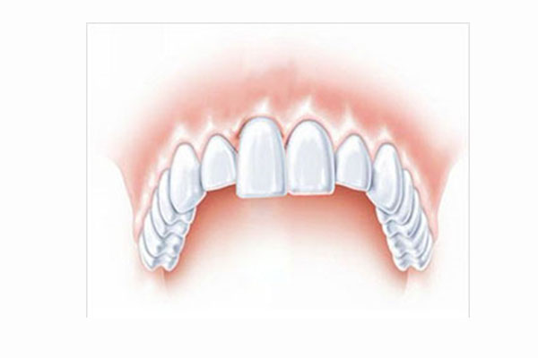 60岁牙龈萎缩是什么原因引起的(60岁牙龈萎缩是什么原因引起的怎么治疗)