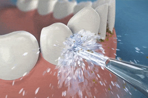 中老年人洗牙后牙齿松动怎么办(中老年人洗牙后牙齿松动怎么办呀)