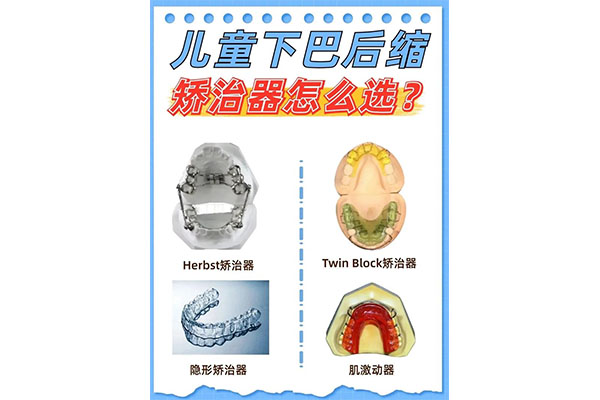 牙排列拥挤有什么影响和危害(牙齿排列拥挤 需要拔掉吗)