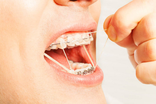 孩子龅牙怎么办 大了会好吗(孩子龅牙怎么办?)