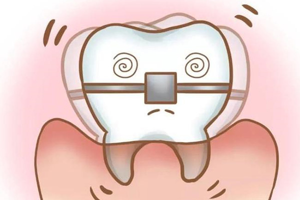 小孩子龅牙是什么原因(小孩呲牙是什么原因)