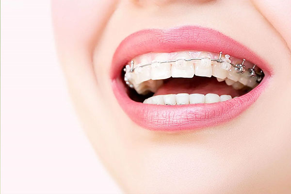 牙列拥挤的矫治方法不包括哪些(牙列拥挤的矫治方法不包括哪些内容)