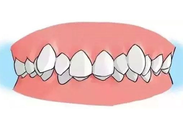 牙不齐导致脸不对称怎么办呀(牙不齐导致脸不对称怎么办呀吃什么药)实战技巧