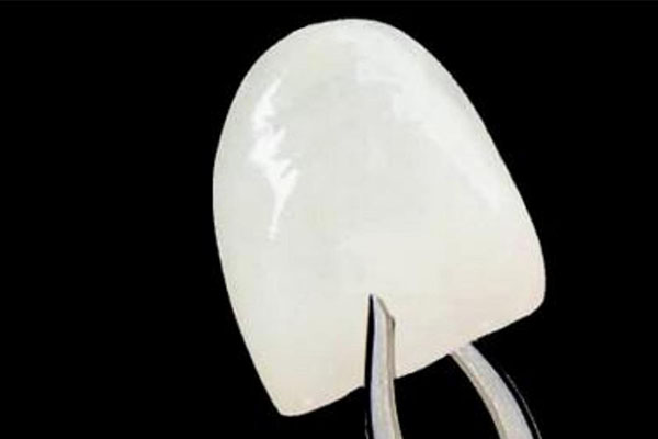 做牙贴面要多长时间(做牙贴面要多长时间恢复)