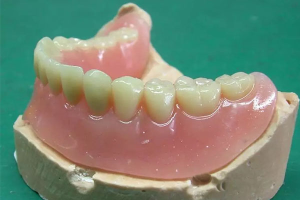 老人装活动假牙用什么材质好呢(老人装活动假牙用什么材质好呢图片)