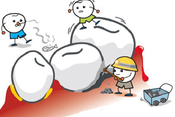 为啥洗牙后口更臭了呢