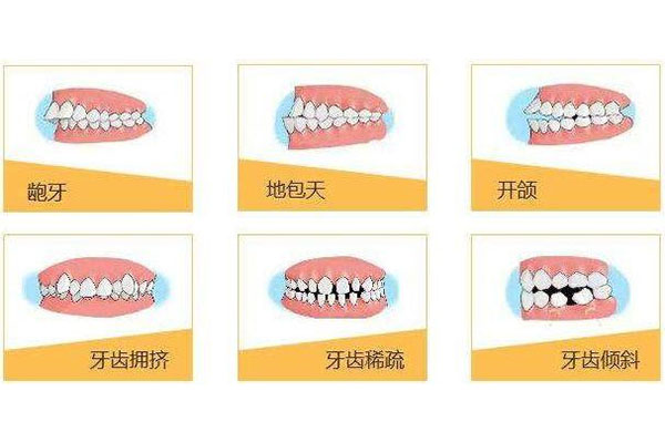 牙不齐有什么好处(牙不齐有什么好处图片)全程一手信息