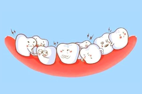 怎么样才是龅牙(怎么才叫龅牙)